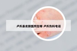 盧氏縣皮膚醫(yī)院在哪 盧氏傷科電話