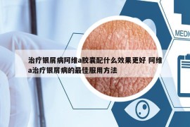 治療銀屑病阿維a膠囊配什么效果更好 阿維a治療銀屑病的最佳服用方法