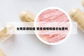 女銀屑病咽痛 銀屑病喉嚨痛會加重嗎