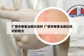 廣德市哪里治癬比較好 廣德市哪里治癬比較好的地方