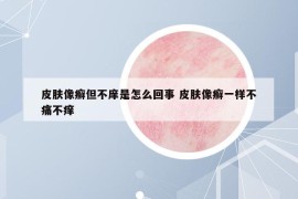 皮膚像癬但不庠是怎么回事 皮膚像癬一樣不痛不癢
