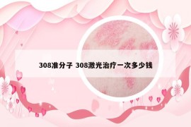 308準(zhǔn)分子 308激光治療一次多少錢