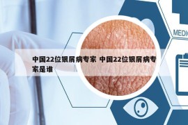中國(guó)22位銀屑病專家 中國(guó)22位銀屑病專家是誰