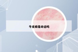 牛皮癬是命運(yùn)嗎