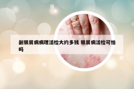 副銀屑病病理活檢大約多錢 銀屑病活檢可怕嗎