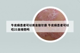 牛皮癬患者可以用金施爾康 牛皮癬患者可以吃21金維他嗎