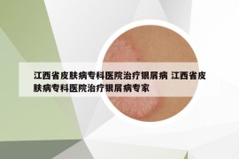 江西省皮膚病專(zhuān)科醫(yī)院治療銀屑病 江西省皮膚病專(zhuān)科醫(yī)院治療銀屑病專(zhuān)家
