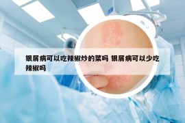 銀屑病可以吃辣椒炒的菜嗎 銀屑病可以少吃辣椒嗎