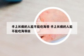 手上長癬的人能不能吃海帶 手上長癬的人能不能吃海帶絲