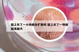 腿上長了一小塊癬會擴散嗎 腿上長了一塊癬越來越大