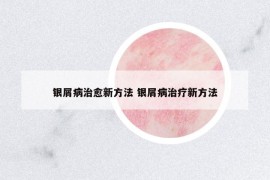 銀屑病治愈新方法 銀屑病治療新方法