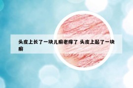 頭皮上長了一塊兒癬老癢了 頭皮上起了一塊癬