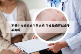不是牛皮癬能吃牛羊肉嗎 牛皮膚癬可以吃牛羊肉嗎