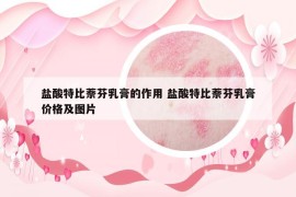 鹽酸特比萘芬乳膏的作用 鹽酸特比萘芬乳膏價格及圖片