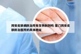 同安皮膚病防治院有生物制劑嗎 廈門同安皮膚防治醫(yī)院的具體地址
