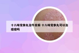 十八味黨參丸治牛皮癬 十八味黨參丸可以治痘痘嗎