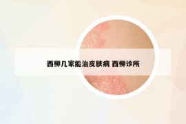 西柳幾家能治皮膚病 西柳診所