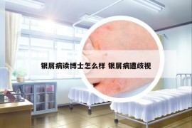 銀屑病讀博士怎么樣 銀屑病遭歧視