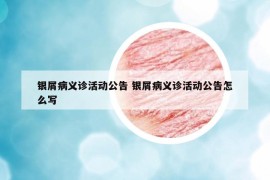 銀屑病義診活動公告 銀屑病義診活動公告怎么寫