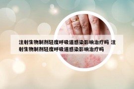 注射生物制劑輕度呼吸道感染影響治療嗎 注射生物制劑輕度呼吸道感染影響治療嗎