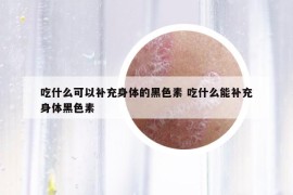 吃什么可以補充身體的黑色素 吃什么能補充身體黑色素