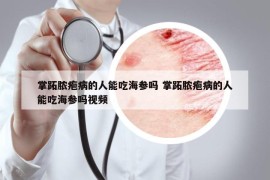掌跖膿皰病的人能吃海參嗎 掌跖膿皰病的人能吃海參嗎視頻
