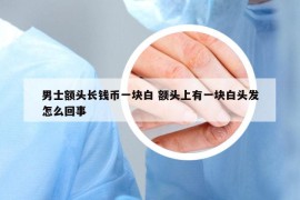 男士額頭長錢幣一塊白 額頭上有一塊白頭發(fā)怎么回事