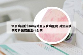 銀屑病治療知m名鴻業(yè)皮膚病醫(yī)院 鴻業(yè)皮膚病?？漆t(yī)院主治什么病