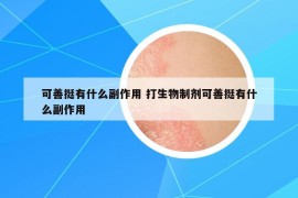 可善挺有什么副作用 打生物制劑可善挺有什么副作用