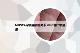 MDSCs與銀屑病的關系 msc治療銀屑病