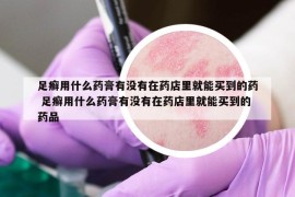 足癬用什么藥膏有沒有在藥店里就能買到的藥 足癬用什么藥膏有沒有在藥店里就能買到的藥品