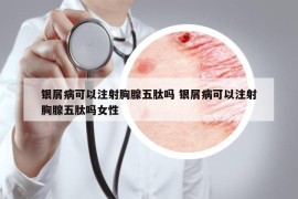 銀屑病可以注射胸腺五肽嗎 銀屑病可以注射胸腺五肽嗎女性