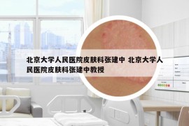 北京大學(xué)人民醫(yī)院皮膚科張建中 北京大學(xué)人民醫(yī)院皮膚科張建中教授