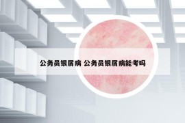 公務(wù)員銀屑病 公務(wù)員銀屑病能考嗎