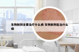 生物制劑主要治療什么病 生物制劑能治什么病