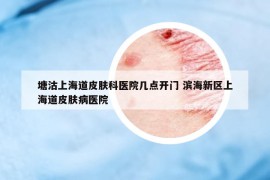 塘沽上海道皮膚科醫(yī)院幾點(diǎn)開(kāi)門(mén) 濱海新區(qū)上海道皮膚病醫(yī)院