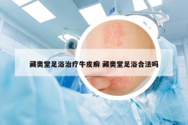 藏奧堂足浴治療牛皮癬 藏奧堂足浴合法嗎