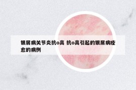 銀屑病關(guān)節(jié)炎抗o高 抗o高引起的銀屑病痊愈的病例