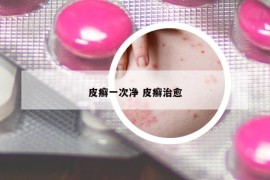 皮癬一次凈 皮癬治愈