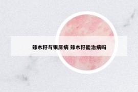 辣木籽與銀屑病 辣木籽能治病嗎