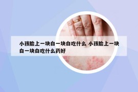 小孩臉上一塊白一塊白吃什么 小孩臉上一塊白一塊白吃什么藥好