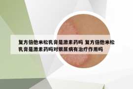 復(fù)方倍他米松乳膏是激素藥嗎 復(fù)方倍他米松乳膏是激素藥嗎對(duì)銀屑病有治療作用嗎