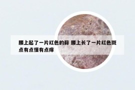 腰上起了一片紅色的蘚 腰上長了一片紅色斑點有點懂有點癢