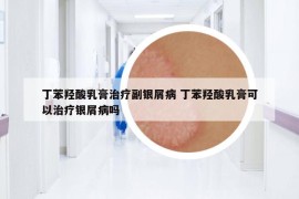 丁苯羥酸乳膏治療副銀屑病 丁苯羥酸乳膏可以治療銀屑病嗎