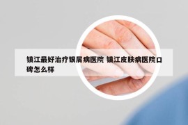 鎮(zhèn)江最好治療銀屑病醫(yī)院 鎮(zhèn)江皮膚病醫(yī)院口碑怎么樣