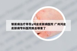 銀屑病治療舉薦y鴻業(yè)皮膚病醫(yī)院 廣州鴻業(yè)皮膚病?？漆t(yī)院搬去哪里了