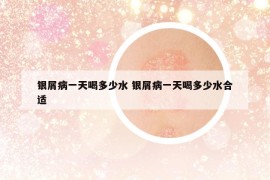 銀屑病一天喝多少水 銀屑病一天喝多少水合適