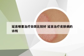延吉哪里治療白斑比較好 延吉治療皮膚病的診所