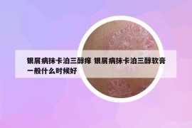 銀屑病抹卡泊三醇癢 銀屑病抹卡泊三醇軟膏一般什么時(shí)候好