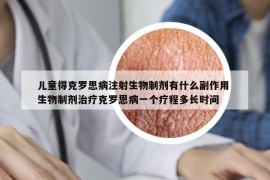 兒童得克羅思病注射生物制劑有什么副作用 生物制劑治療克羅恩病一個(gè)療程多長(zhǎng)時(shí)間